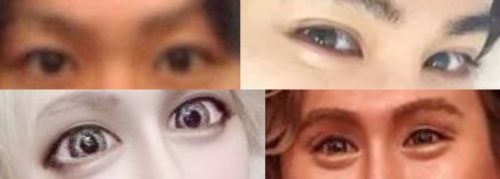 アレンの目